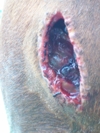 A large tumor was removed from his chest.  This was the gaping wound left after the tumor was removed.